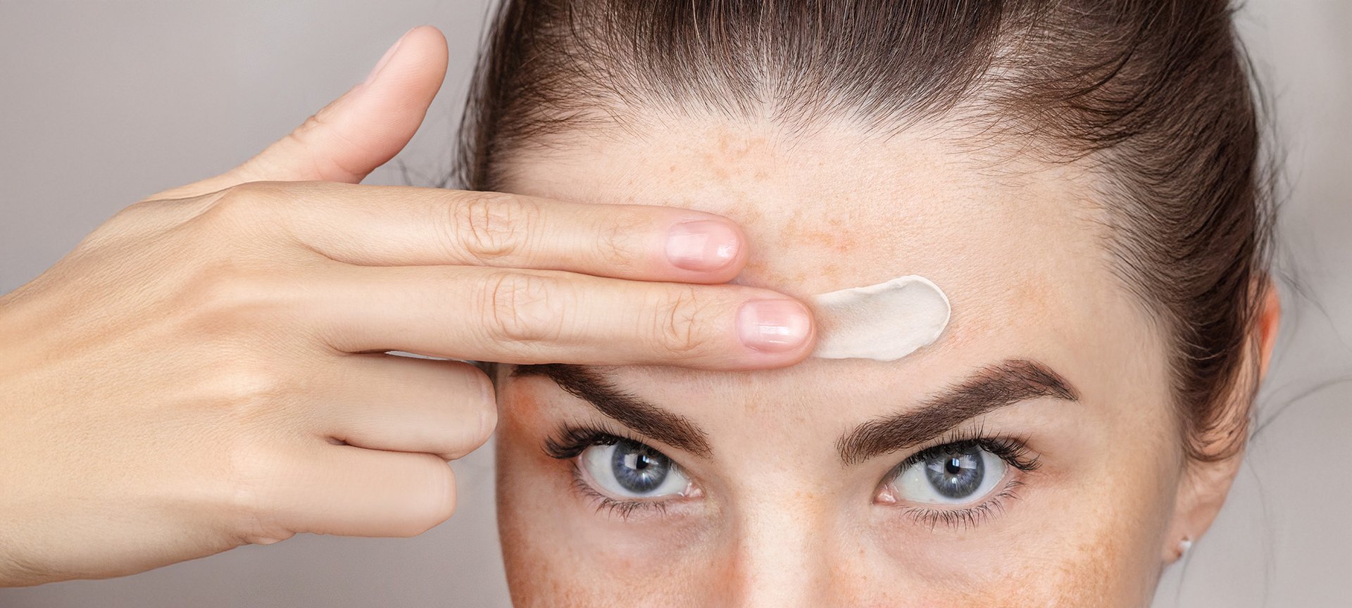 kobieta z przebarwieniami posłonecznymi na twarzy, smarująca je kremem