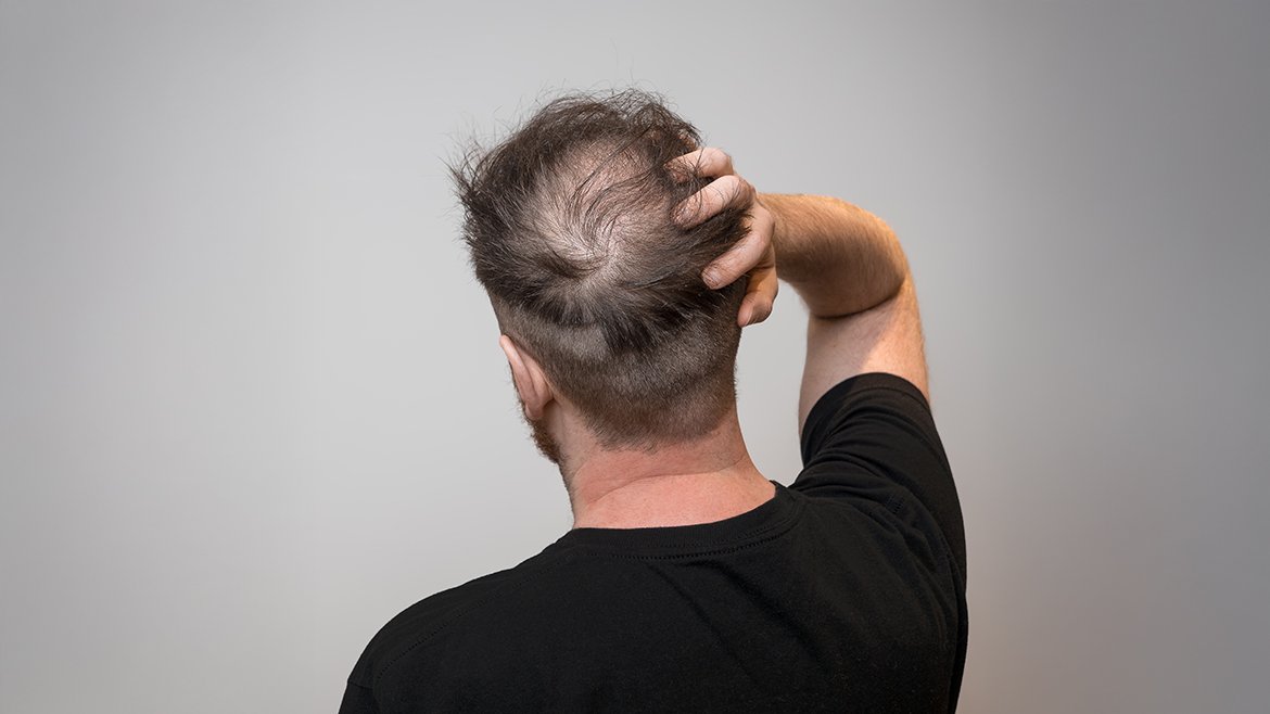AdobeStock 423585539 1170x658