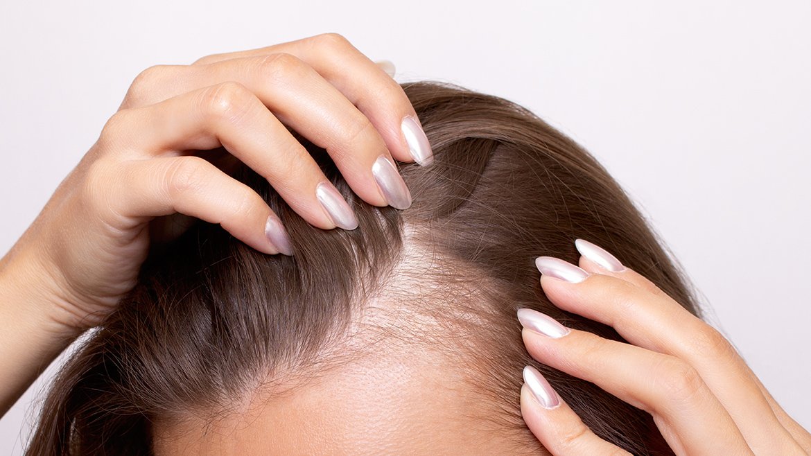 AdobeStock 960143912 1170x658