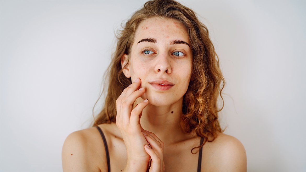 AdobeStock 735914064 1170x658