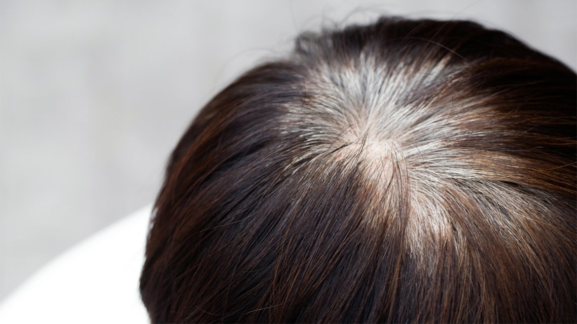 Widoczne od góry duże siwe odrosty na ciemnych włosach