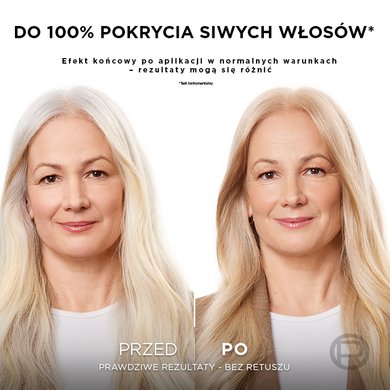 20231023digitalexcellencecremetriplecarecoloreubeforeafter9ATF06nadmiimagenanocta V2