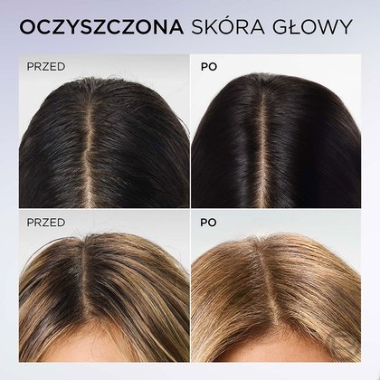 Elseve Hyaluron Pure szampon