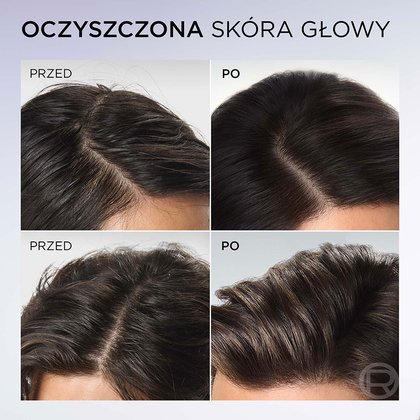 Elseve Hyaluron Pure szampon