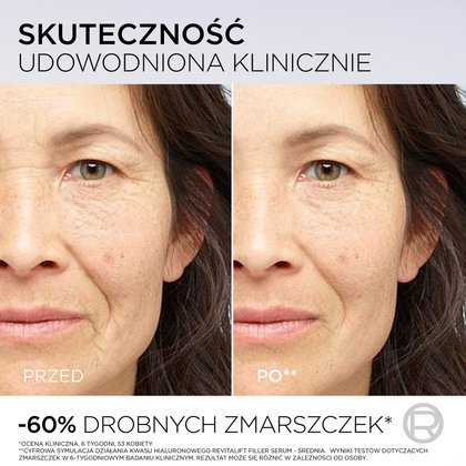 15 Skin Care RVT HA ACID PDRN SE